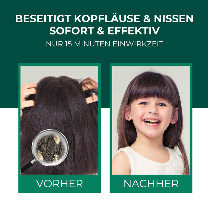 Kopfläuse-Shampoo - Läuseshampoo für Kinder & Erwachsene inkl. Nissenkamm Läuse Shampoo - Silberkraft