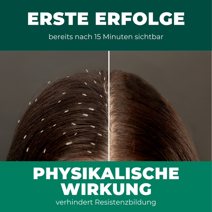 Kopfläuse-Shampoo - Läuseshampoo für Kinder & Erwachsene inkl. Nissenkamm Läuse Shampoo - Silberkraft
