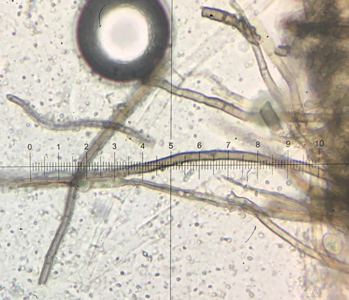Chaetomium — foto 3 van 21