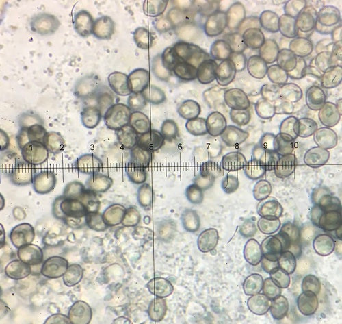 Chaetomium — foto 4 van 21