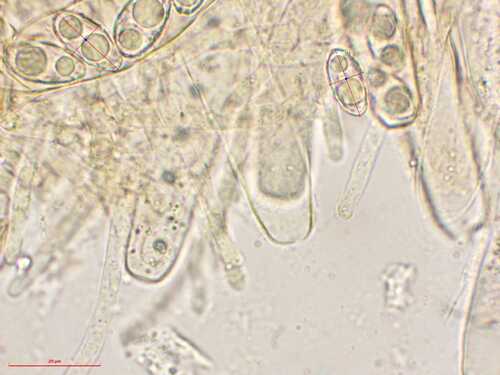 Bruine cupling — foto 4 van 8