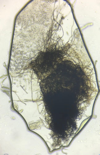 Chaetomium — Bild 4