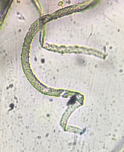 Chaetomium — Bild 5