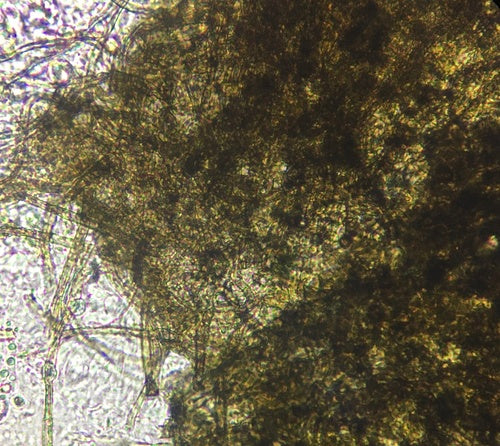 Chaetomium — Bild 3