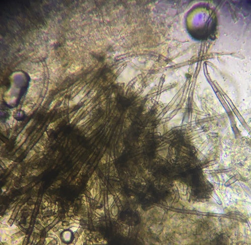 Chaetomium globosum — foto 5 van 21