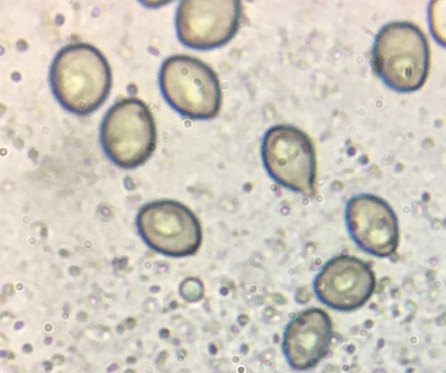 Chaetomium globosum — foto 2 van 21