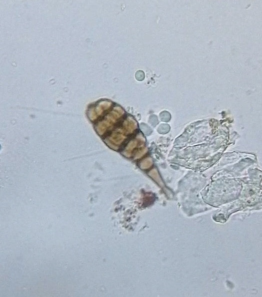 Alternaria — foto 5 van 8