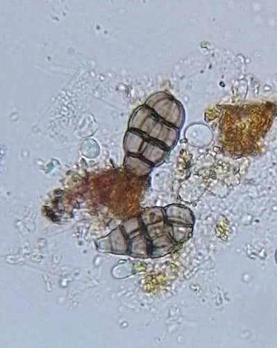 Ulocladium — Bild 4