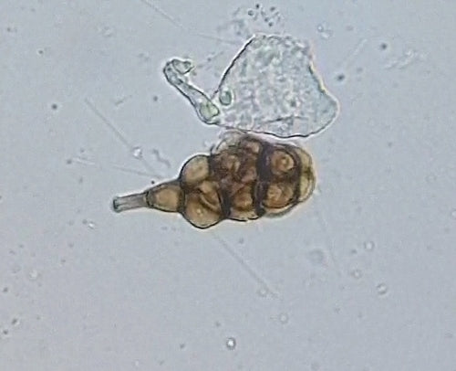 Ulocladium — Bild 3